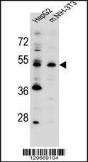 Anti-KCMF1 Rabbit Polyclonal Antibody (APC (Allophycocyanin))