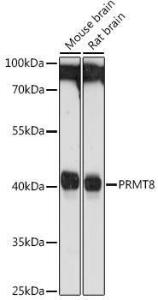 Western blot analysis of extracts of various cell lines, using Anti-PRMT8 Antibody (A9037) at 1:1,000 dilution. The secondary antibody was Goat Anti-Rabbit IgG H&L Antibody (HRP) at 1:10,000 dilution.