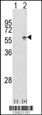 Anti-CCT3 Rabbit Polyclonal Antibody