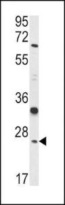 Anti-GSTM1 Rabbit Polyclonal Antibody (Biotin)