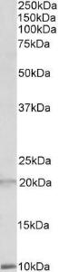 Anti-DEFA1/3 Antibody (A83486) (2µg/ml) staining of Human Spleen lysate (35µg protein in RIPA buffer). Primary incubation was 1 hour. Detected by chemiluminescence.