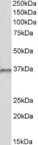 Anti-HOXC10 Antibody (A85151) (1µg/ml) staining of HepG2 lysate (35µg protein in RIPA buffer). Primary incubation was 1 hour. Detected by chemiluminescence.