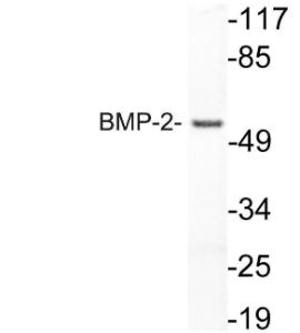 Western blot analysis of lysate from HUVEC cells using Anti-BMP-2 Antibody