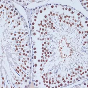 Immunohistochemistry analysis of paraffin-embedded rat testis using Anti-Dnmt3L Antibody (A9041) at a dilution of 1:100 (40X lens). Perform microwave antigen retrieval with 10 mM PBS buffer pH 7.2 before commencing with IHC staining protocol