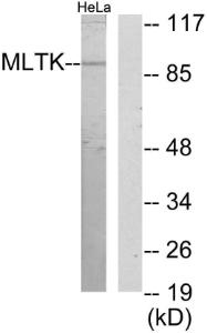 Western blot analysis of lysates from HeLa cells using Anti-MLTK Antibody. The right hand lane represents a negative control, where the Antibody is blocked by the immunising peptide