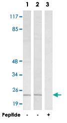 Anti-HSPB2 Rabbit Polyclonal Antibody