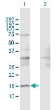 Anti-SRP19 Rabbit Polyclonal Antibody