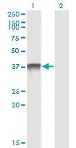 Anti-SDSL Mouse Monoclonal Antibody [clone: 1D6-6B8]