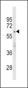 Anti-APEX2 Rabbit Polyclonal Antibody