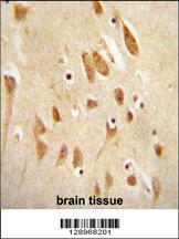 Anti-MAPK8 Rabbit Polyclonal Antibody (FITC (Fluorescein Isothiocyanate))