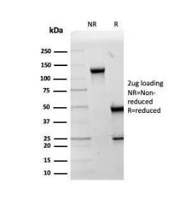 Antibody anti-HSP60 LK2 bsid 100 µg