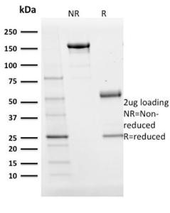 SDS-PAGE analysis of Anti-BOB1 Antibody [BOB1/2424] under non-reduced and reduced conditions; showing intact IgG and intact heavy and light chains, respectively. SDS-PAGE analysis confirms the integrity and purity of the antibody