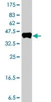 Anti-AGTPBP1 Mouse Polyclonal Antibody