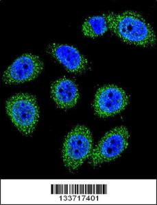 Anti-MBL2 Rabbit Polyclonal Antibody (Biotin)