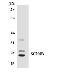 Anti-SCN4B Rabbit Polyclonal Antibody