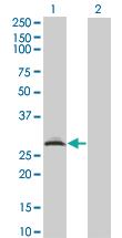 Anti-RAD1 Mouse Monoclonal Antibody [clone: 1G2]