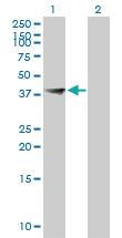 Anti-FBXO28 Mouse Polyclonal Antibody