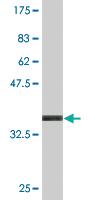 Anti-KLHL4 Mouse Monoclonal Antibody [clone: 4B6]