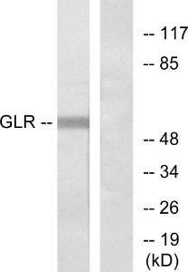 Western blot analysis of lysates from COLO205 cells using Anti-GLR Antibody The right hand lane represents a negative control, where the antibody is blocked by the immunising peptide