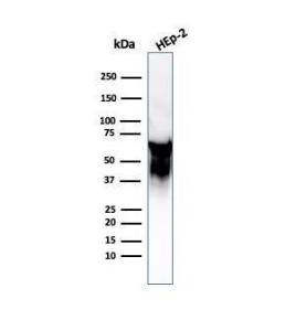 Antibody anti-HSP60 LK2 bsid 100 µg