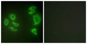 Immunofluorescence analysis of HepG2 cells using Anti-MLTK Antibody. The right hand panel represents a negative control, where the Antibody was pre-incubated with the immunising peptide