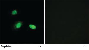 Anti-HSPB2 Rabbit Polyclonal Antibody