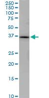 Anti-PNMA1 Mouse Monoclonal Antibody [clone: 1C3]