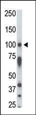 Anti-STK31 Rabbit Polyclonal Antibody (APC (Allophycocyanin))