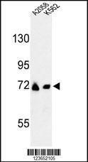 Anti-GFPT2 Rabbit Polyclonal Antibody