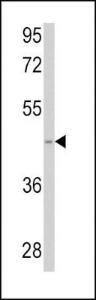 Anti-SPHK1 Rabbit Polyclonal Antibody (AP (Alkaline Phosphatase))