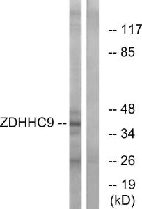 Western blot analysis of lysates from COLO cells using Anti-ZDHHC9 Antibody. The right hand lane represents a negative control, where the Antibody is blocked by the immunising peptide