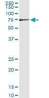 Anti-MPP2 Mouse Monoclonal Antibody [clone: 2B1]