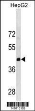 Anti-LRRC19 Rabbit Polyclonal Antibody