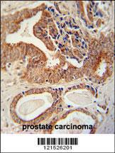 Anti-IGF2BP1 Rabbit Polyclonal Antibody (HRP (Horseradish Peroxidase))