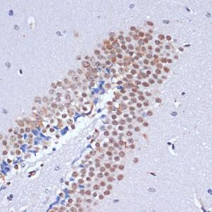 Immunohistochemistry analysis of paraffin-embedded mouse brain using Anti-Dnmt3L Antibody (A9041) at a dilution of 1:100 (40X lens). Perform microwave antigen retrieval with 10 mM PBS buffer pH 7.2 before commencing with IHC staining protocol