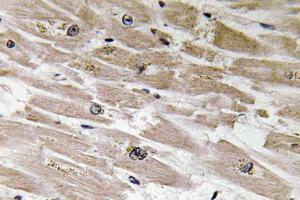 Immunohistochemical analysis of paraffin-embedded human heart tissue using Anti-BMP-2 Antibody