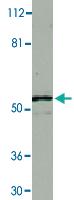 Anti-IKBKG Rabbit Polyclonal Antibody