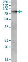 Anti-ABCB5 Goat Polyclonal Antibody