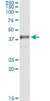 Anti-SDSL Mouse Monoclonal Antibody [clone: 1D6-6B8]