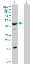 Anti-ASB6 Mouse Polyclonal Antibody