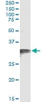 Anti-HCCS Antibody Pair