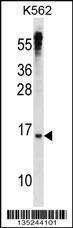 Anti-MXD3 Rabbit Polyclonal Antibody (APC (Allophycocyanin))