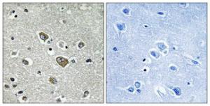 Immunohistochemical analysis of paraffin-embedded human brain tissue using Anti-ZDHHC9 Antibody. The right hand panel represents a negative control, where the Antibody was pre-incubated with the immunising peptide