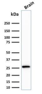 Western blot analysis of human brain tissue lysate using Anti-Calretinin Antibody [CALB2/2807]