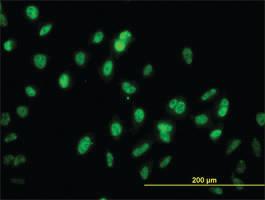 Anti-GABPA Mouse Monoclonal Antibody [clone: 1D6]