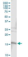 Anti-SRP19 Rabbit Polyclonal Antibody