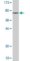 Anti-PIP4K2A Mouse Monoclonal Antibody [clone: 3H5]