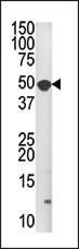 Anti-MKNK1 Rabbit Polyclonal Antibody (Biotin)