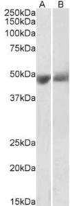 Anti-SERPINF1 antibody