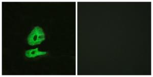 Immunofluorescence analysis of HeLa cells using Anti-GLR Antibody The right hand panel represents a negative control, where the antibody was pre-incubated with the immunising peptide